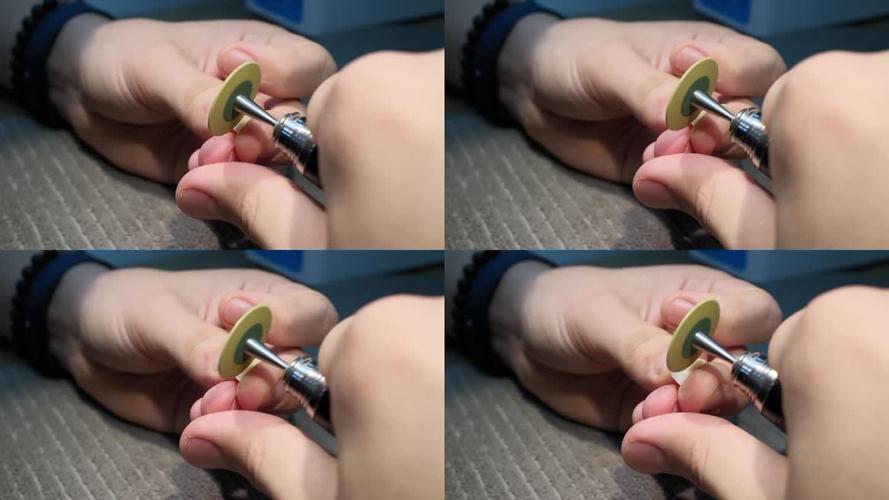 technician works on veneer