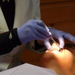 Why didn't the dentist repair your broken tooth, but did a root canal treatment?