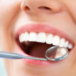 What is easy to use for whitening teeth? Baking soda and teeth scaling are also OK?