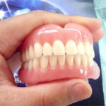 Is there a retention period for dentures? Do you want to replace it with a new one every few years?