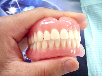 Is there a retention period for dentures? Do you want to replace it with a new one every few years?