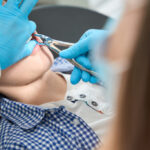 Socket Preservation After Tooth Extraction: Why it Matters