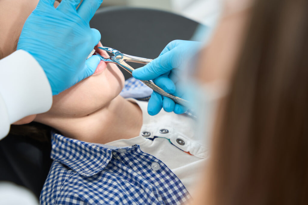 Socket Preservation After Tooth Extraction: Why it Matters