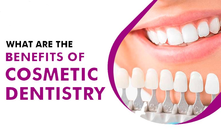 What Are The Benefits Of Cosmetic Dentistry