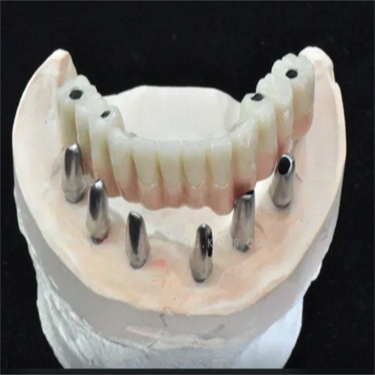 full dentures with titanium implant abutment base