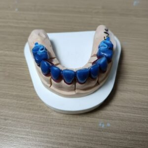 full hand curved wax model for precision attachment