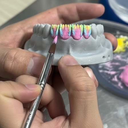 manual hand inner laying skill for anterior case