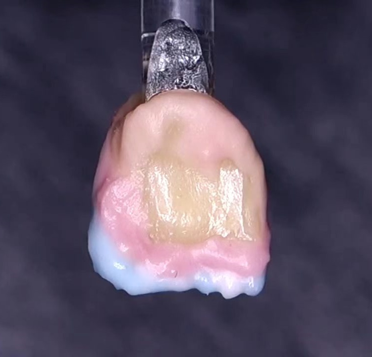 nature tooth structure and shade fabricated by dental technician manual layering